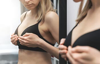 How Do I Know if I Need a Breast Lift?